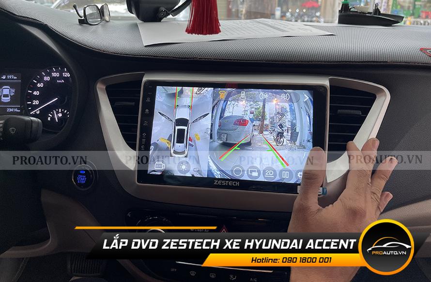 Lắp màn hình dvd tại nhà uy tín